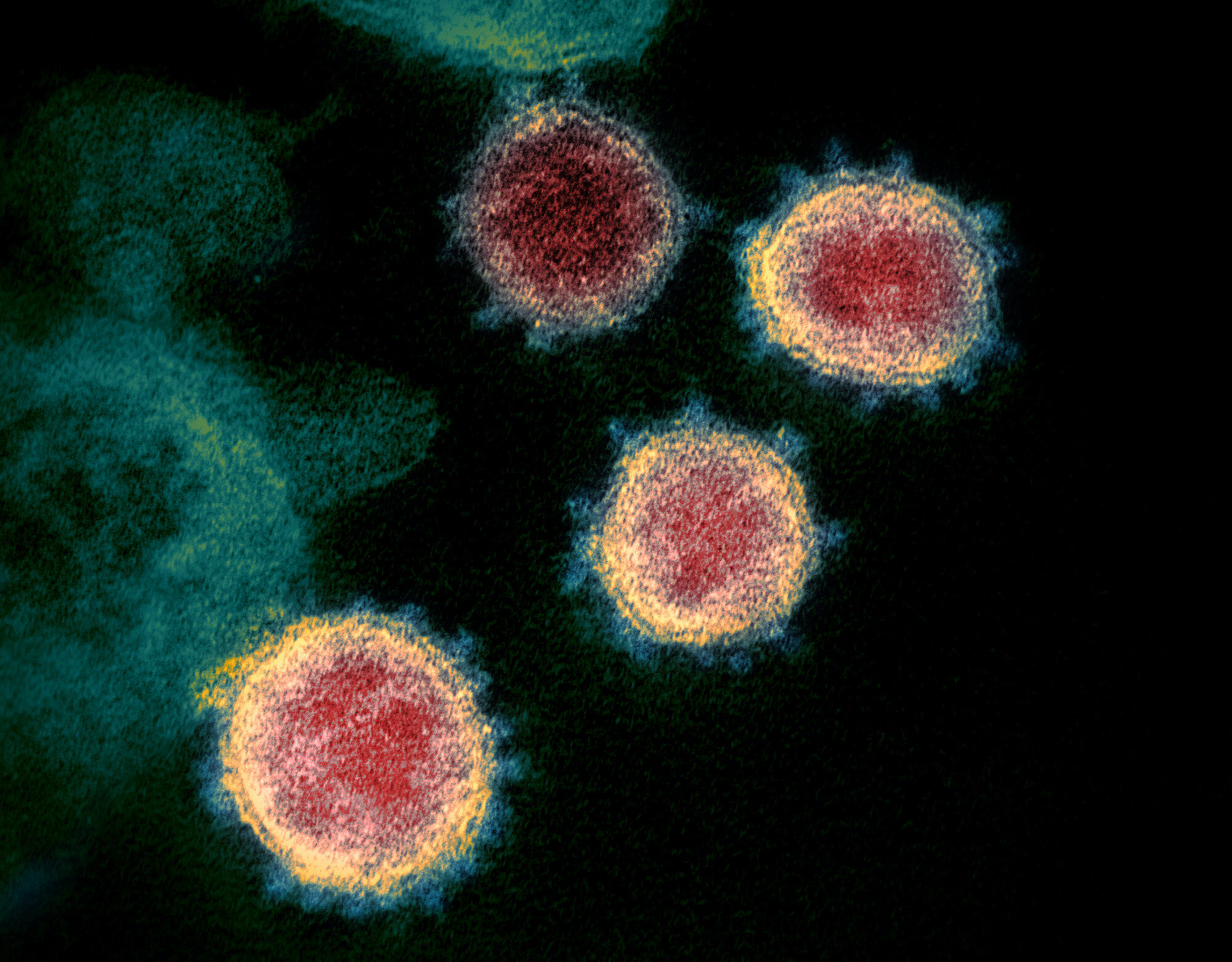 Nouveau coronavirus SARS-Cov-2 observé au microscope électronique à balayage -- CC 2.0 NIAID
