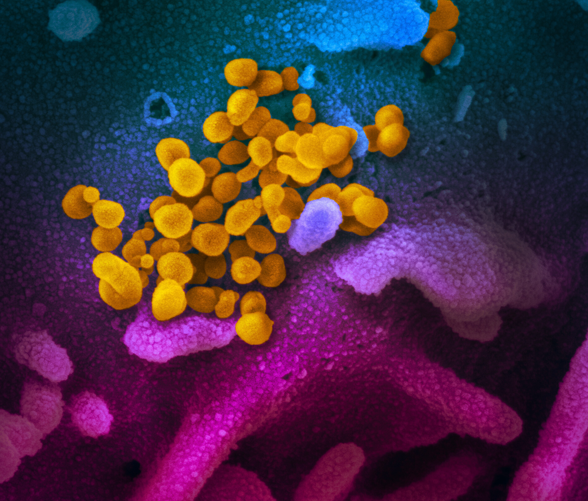 Désinfection du COVID-19 en Haute-Savoie : Nouveau coronavirus SARS-Cov-2 observé au microscope électronique à balayage -- CC 2.0 NIAID