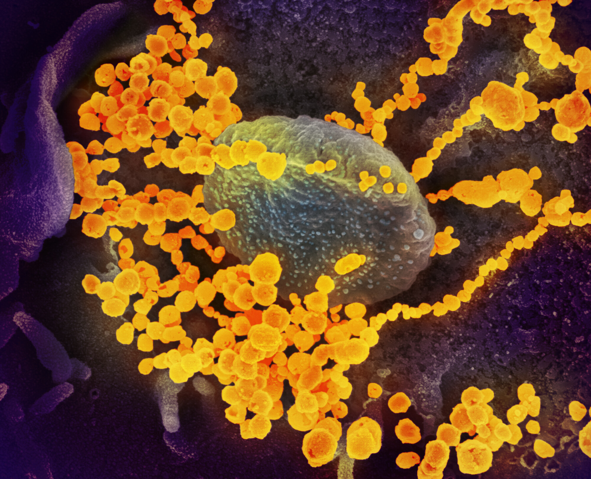 Nouveau coronavirus SARS-Cov-2 observé au microscope électronique à balayage -- CC 2.0 NIAID